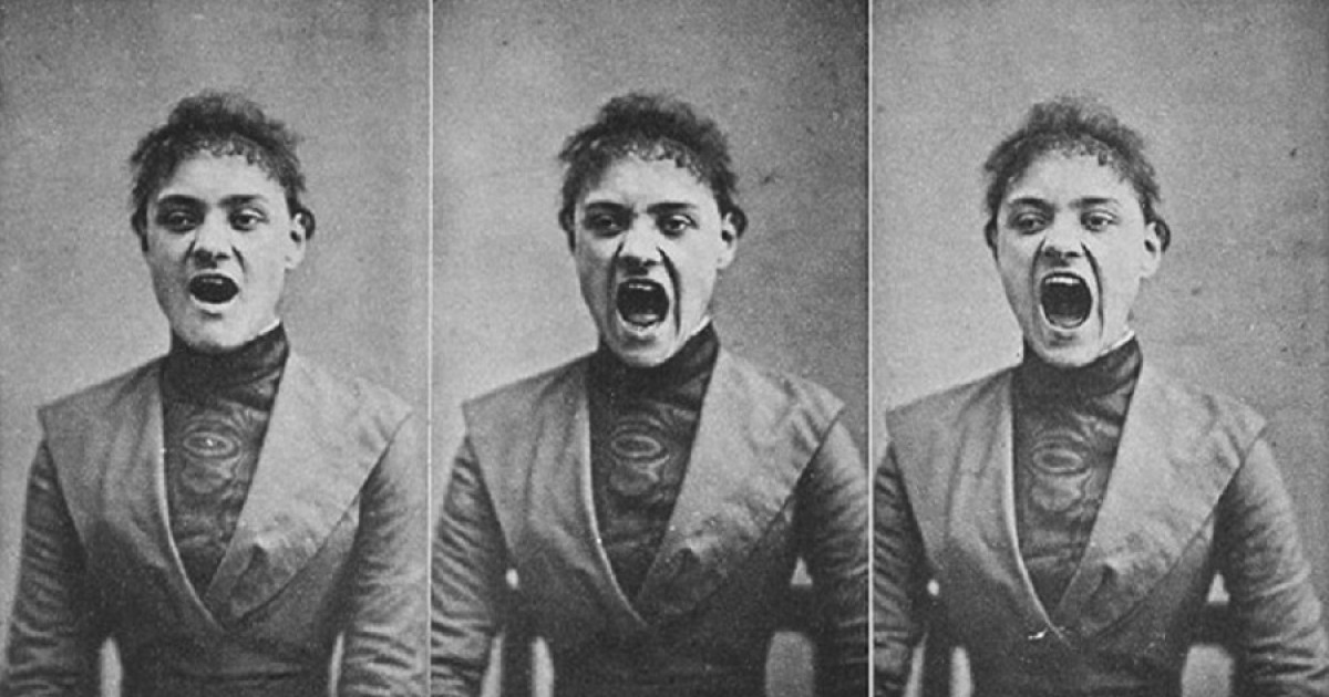 La fibromialgia como síntoma histérico